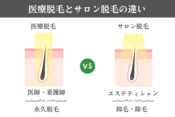 医療脱毛とサロン脱毛の違い